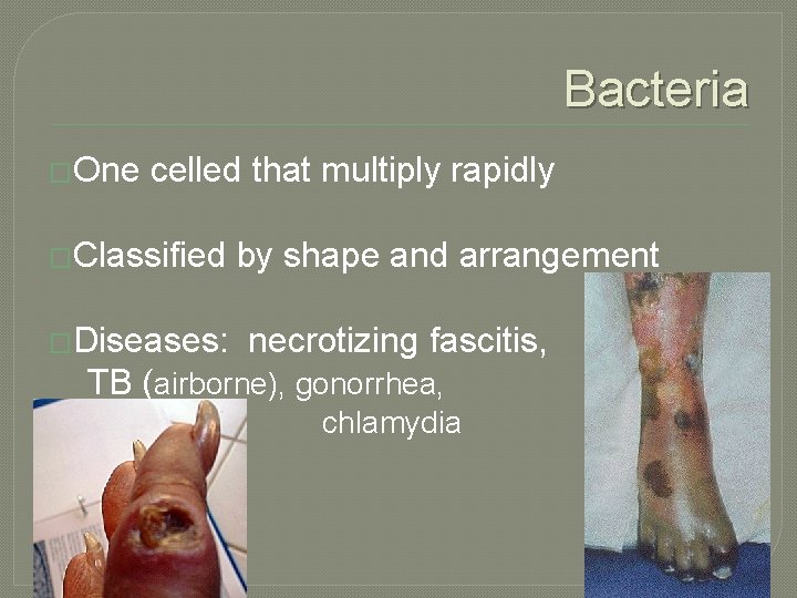 Bacteria �One celled that multiply rapidly �Classified �Diseases: by shape and arrangement necrotizing fascitis,