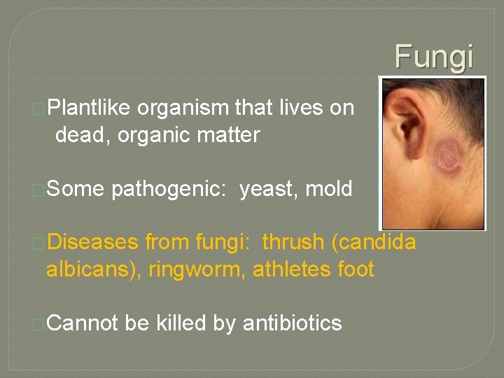 Fungi �Plantlike organism that lives on dead, organic matter �Some pathogenic: yeast, mold �Diseases