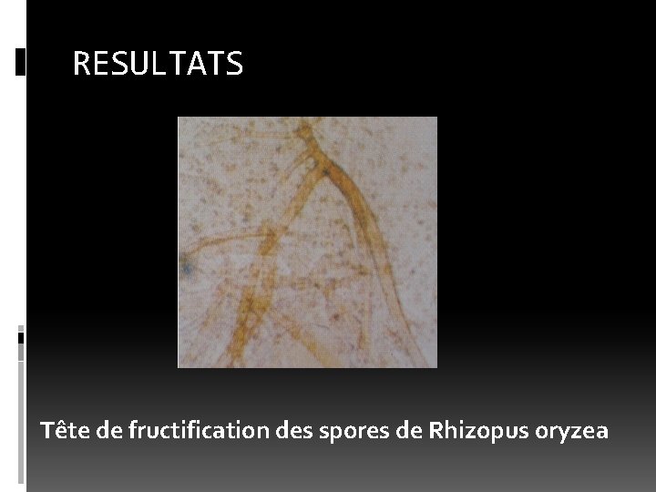 RESULTATS Tête de fructification des spores de Rhizopus oryzea 