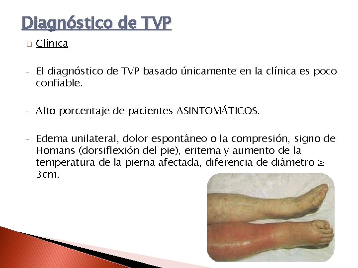 Diagnóstico de TVP � Clínica - El diagnóstico de TVP basado únicamente en la