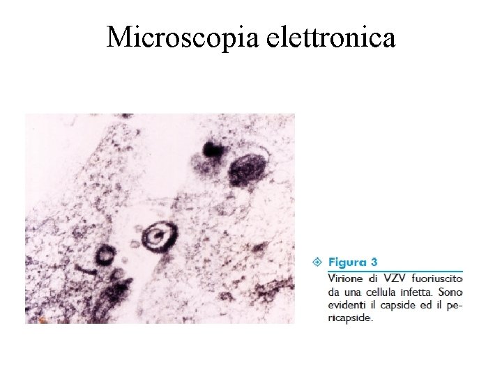 Microscopia elettronica 