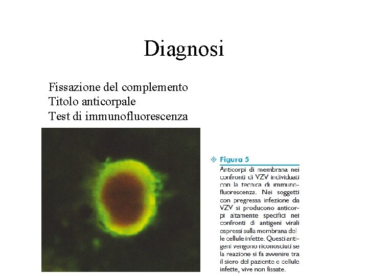 Diagnosi Fissazione del complemento Titolo anticorpale Test di immunofluorescenza 