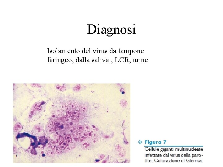 Diagnosi Isolamento del virus da tampone faringeo, dalla saliva , LCR, urine 