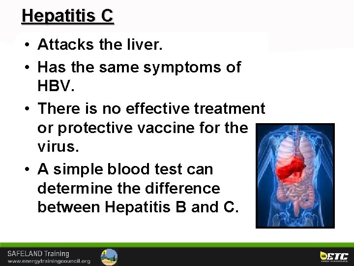 Hepatitis C • Attacks the liver. • Has the same symptoms of HBV. •
