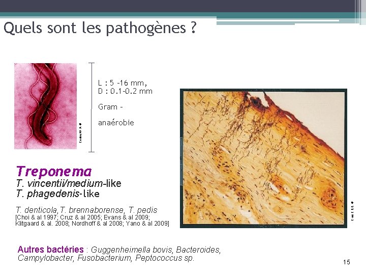 Quels sont les pathogènes ? L : 5 -16 mm, D : 0. 1