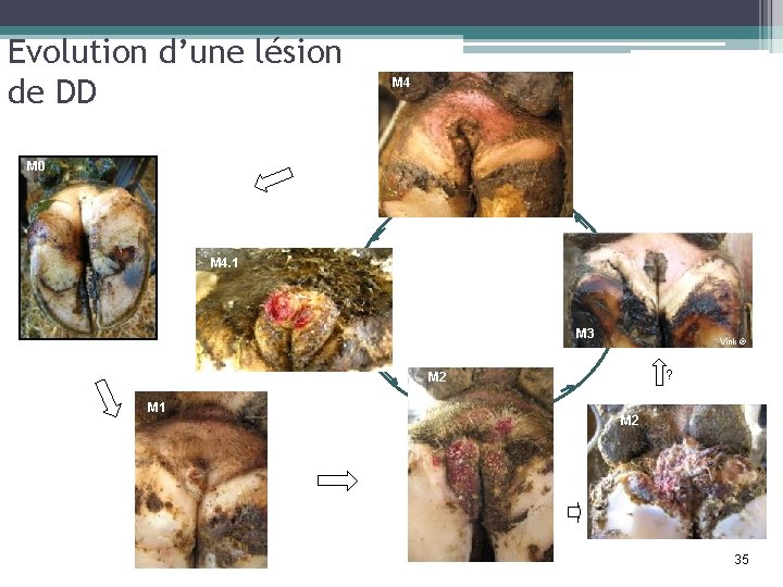 Evolution d’une lésion de DD M 4 M 0 M 4. 1 M 3