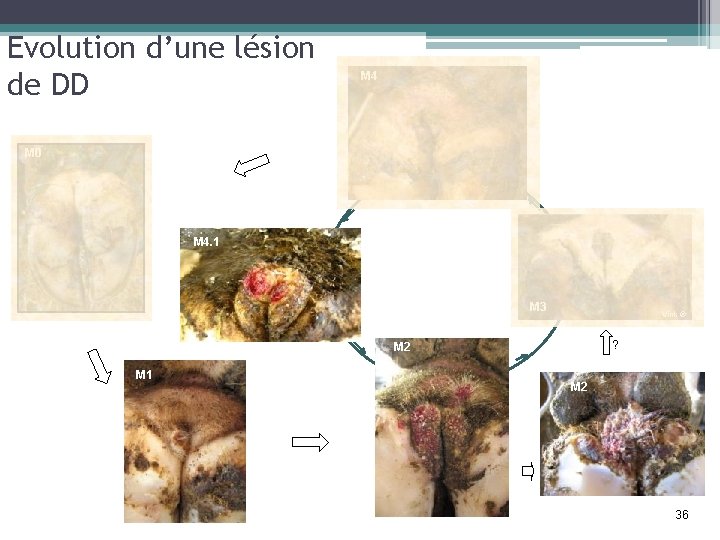 Evolution d’une lésion de DD M 4 M 0 M 4. 1 M 3