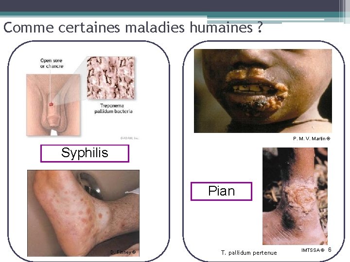 Comme certaines maladies humaines ? P. M. V. Martin ® Syphilis Pian D. Finney
