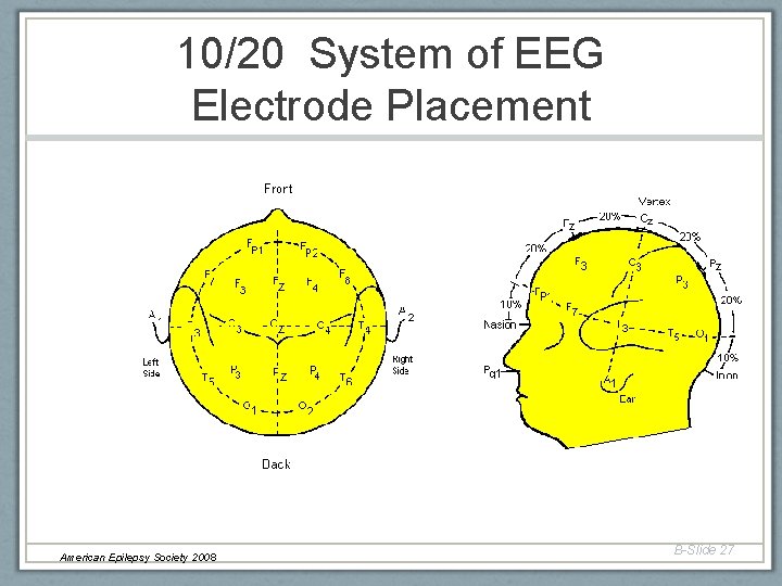 10/20 System of EEG Electrode Placement American Epilepsy Society 2008 B-Slide 27 10/20 System of EEG Electrode Placement American Epilepsy Society 2008 B-Slide 27