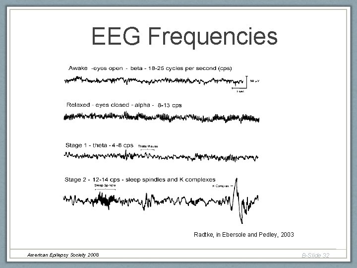 EEG Frequencies Radtke, in Ebersole and Pedley, 2003 American Epilepsy Society 2008 B-Slide 32