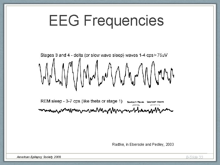 EEG Frequencies Radtke, in Ebersole and Pedley, 2003 American Epilepsy Society 2008 B-Slide 33 EEG Frequencies Radtke, in Ebersole and Pedley, 2003 American Epilepsy Society 2008 B-Slide 33