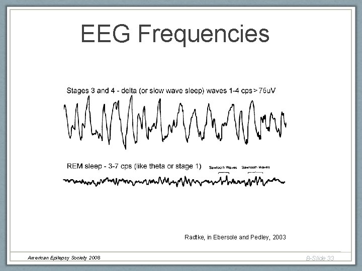 EEG Frequencies Radtke, in Ebersole and Pedley, 2003 American Epilepsy Society 2008 B-Slide 33