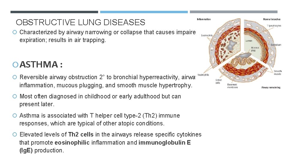 OBSTRUCTIVE LUNG DISEASES Characterized by airway narrowing or collapse that causes impaired expiration; results