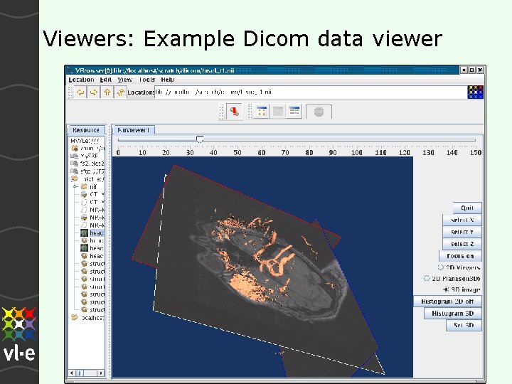 Viewers: Example Dicom data viewer 