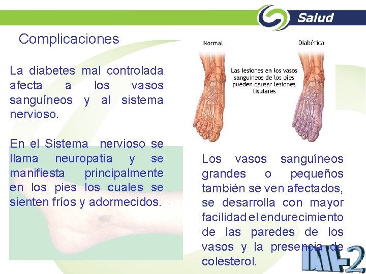 Complicaciones La diabetes mal controlada afecta a los vasos sanguíneos y al sistema nervioso.