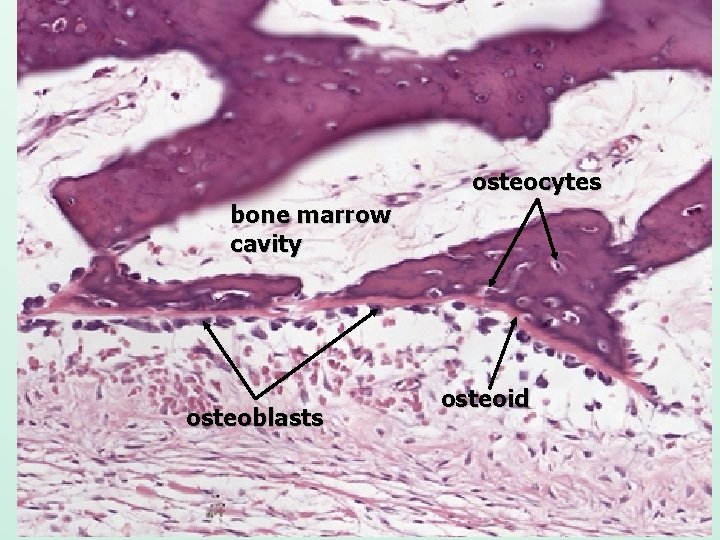 osteocytes bone marrow cavity osteoblasts osteoid 