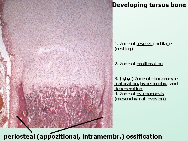 Developing tarsus bone 1. Zone of reserve cartilage (resting) 2. Zone of proliferation 3.