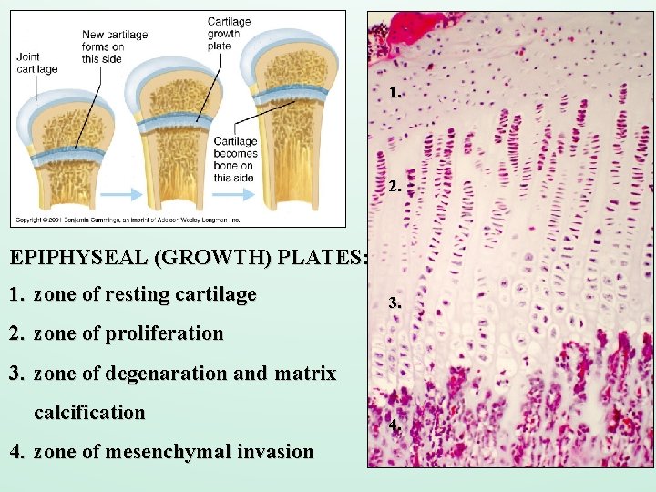 1. 2. EPIPHYSEAL (GROWTH) PLATES: 1. zone of resting cartilage 3. 2. zone of
