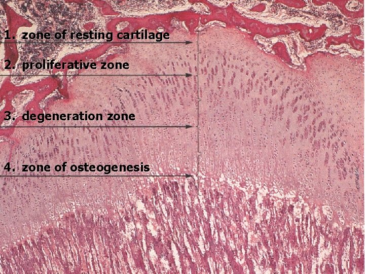 1. zone of resting cartilage 2. proliferative zone 3. degeneration zone 4. zone of