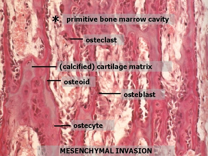 * primitive bone marrow cavity osteclast (calcified) cartilage matrix osteoid osteblast ostecyte MESENCHYMAL INVASION