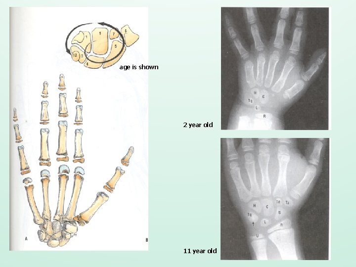 age is shown 2 year old 11 year old 