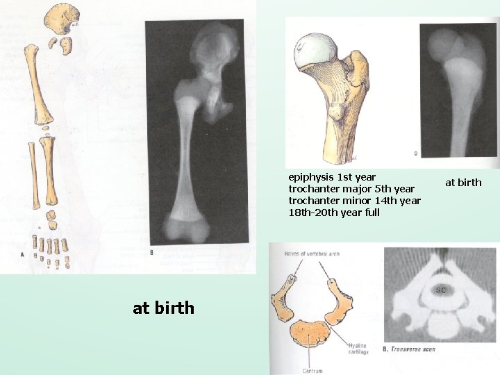 epiphysis 1 st year trochanter major 5 th year trochanter minor 14 th year