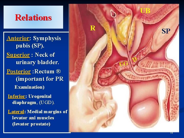 UB Relations R Anterior: Symphysis pubis (SP). Superior : Neck of urinary bladder. Posterior