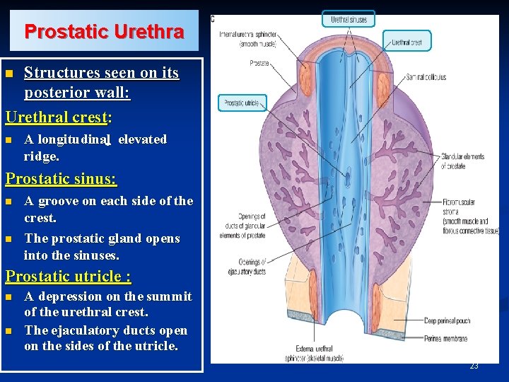 Prostatic Urethra Structures seen on its posterior wall: Urethral crest: n n A longitudinal