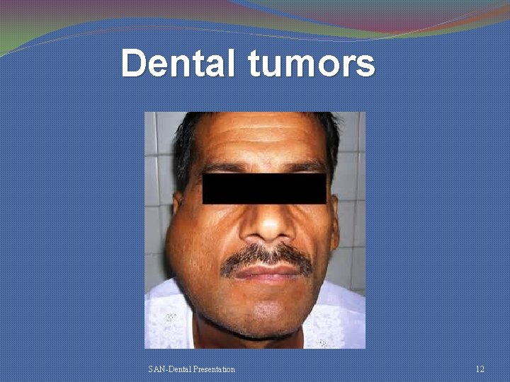 Dental tumors SAN-Dental Presentation 12 