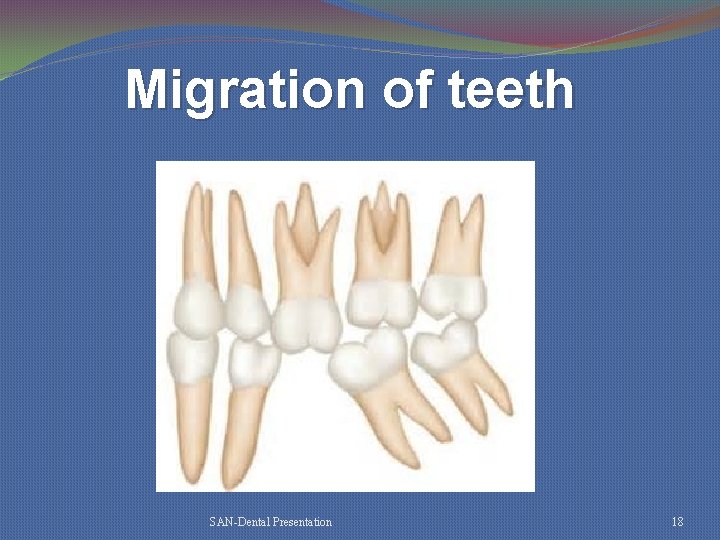 Migration of teeth SAN-Dental Presentation 18 