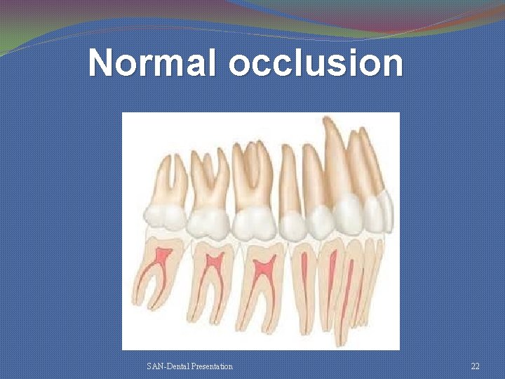 Normal occlusion SAN-Dental Presentation 22 