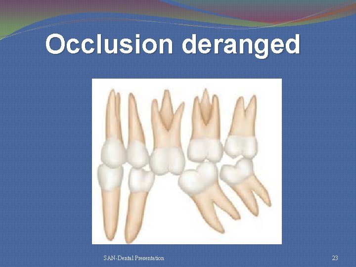 Occlusion deranged SAN-Dental Presentation 23 
