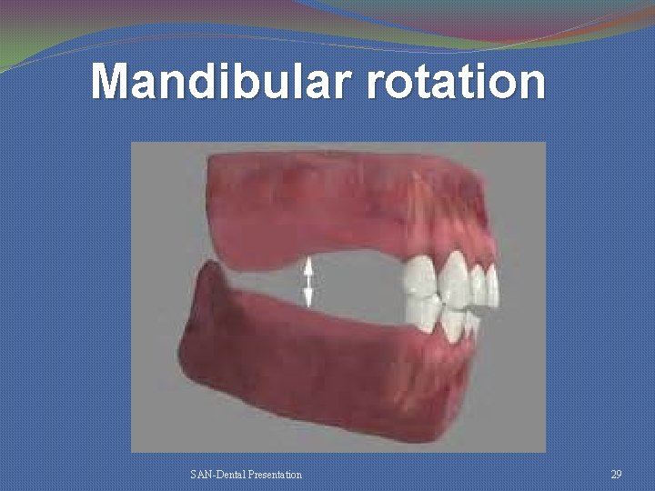 Mandibular rotation SAN-Dental Presentation 29 