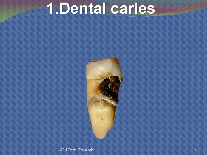 1. Dental caries SAN-Dental Presentation 4 