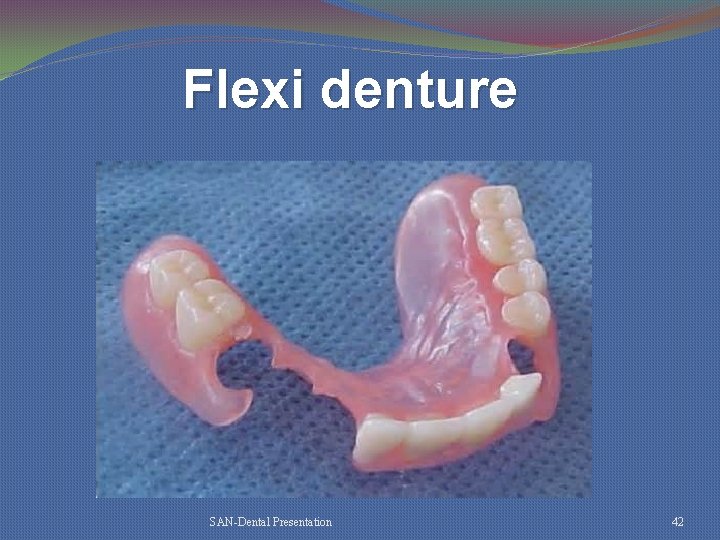 Flexi denture SAN-Dental Presentation 42 