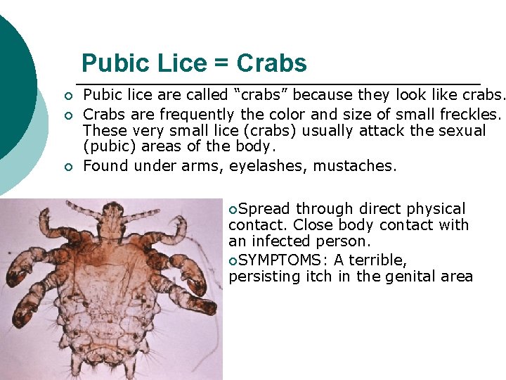 Pubic Lice = Crabs ¡ ¡ ¡ Pubic lice are called “crabs” because they