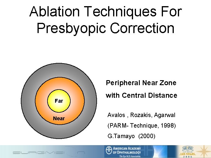 Ablation Techniques For Presbyopic Correction Peripheral Near Zone Far Near with Central Distance Avalos