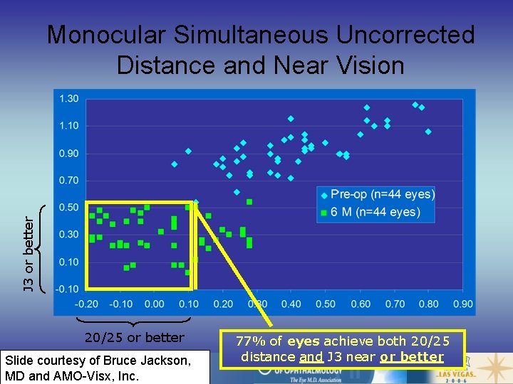 J 3 or better Monocular Simultaneous Uncorrected Distance and Near Vision 20/25 or better