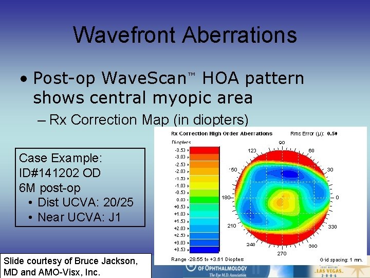 Wavefront Aberrations • Post-op Wave. Scan™ HOA pattern shows central myopic area – Rx