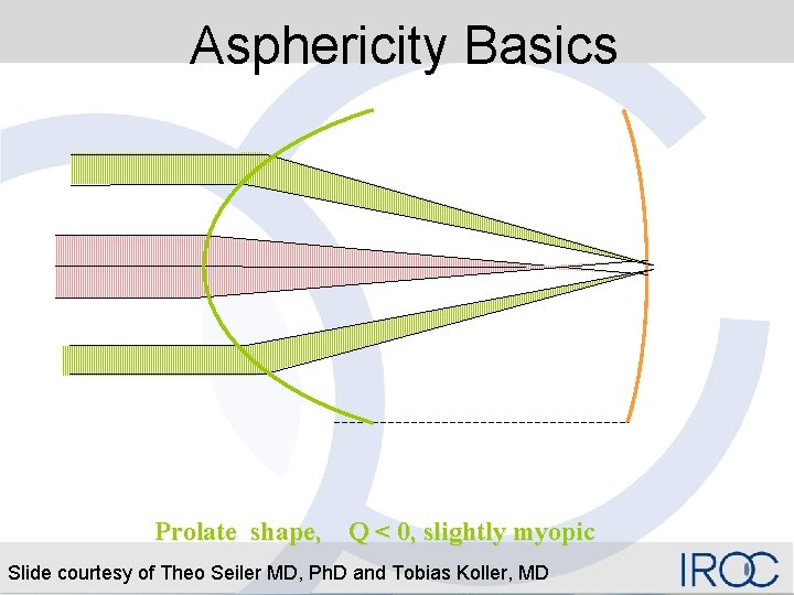 Asphericity Basics Prolate shape, Q < 0, slightly myopic Slide courtesy of Theo Seiler