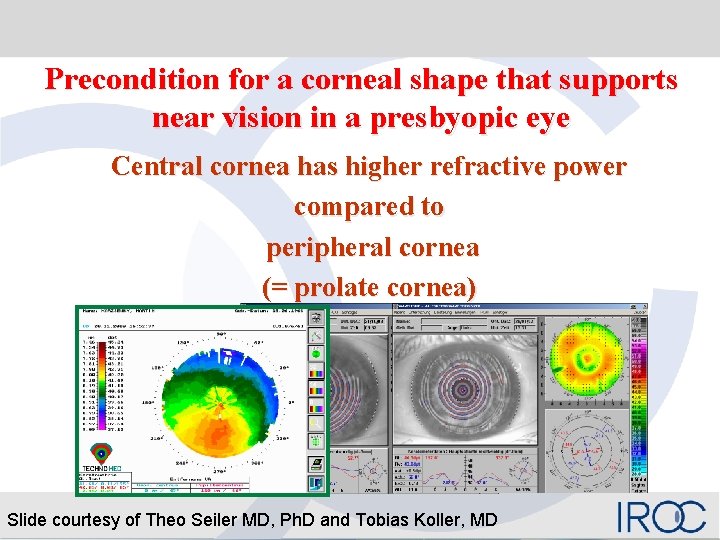 Precondition for a corneal shape that supports near vision in a presbyopic eye Central