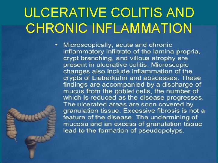 ULCERATIVE COLITIS AND CHRONIC INFLAMMATION 