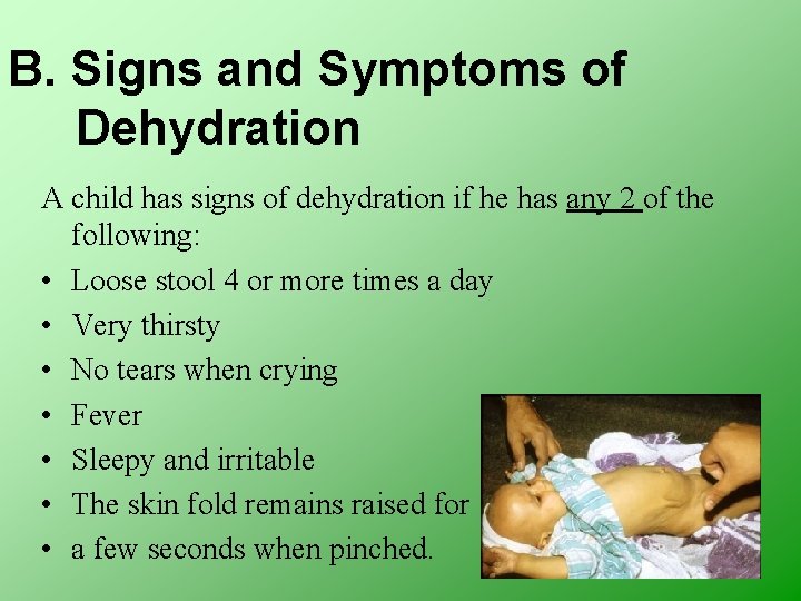 B. Signs and Symptoms of Dehydration A child has signs of dehydration if he