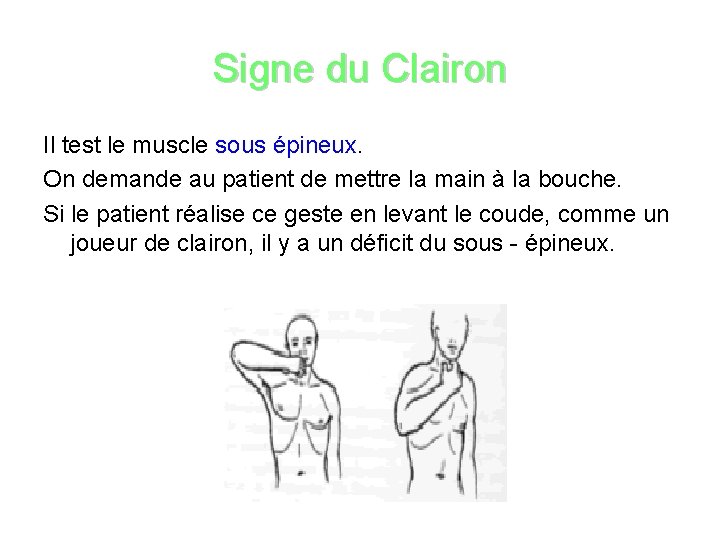 Signe du Clairon Il test le muscle sous épineux. On demande au patient de
