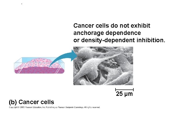 . Cancer cells do not exhibit anchorage dependence or density-dependent inhibition. 25 µm Cancer