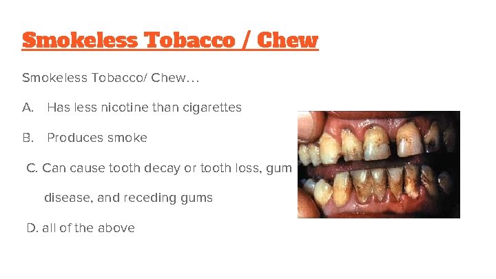 Smokeless Tobacco / Chew Smokeless Tobacco/ Chew… A. Has less nicotine than cigarettes B.