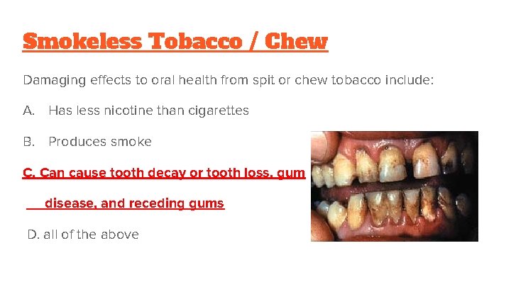 Smokeless Tobacco / Chew Damaging effects to oral health from spit or chew tobacco