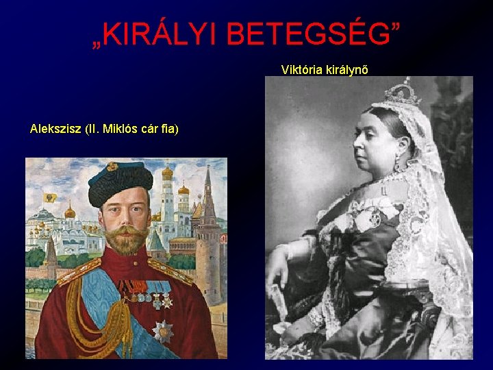 „KIRÁLYI BETEGSÉG” Viktória királynő Alekszisz (II. Miklós cár fia) 