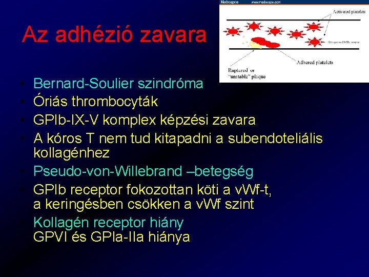 Az adhézió zavara • • Bernard-Soulier szindróma Óriás thrombocyták GPIb-IX-V komplex képzési zavara A