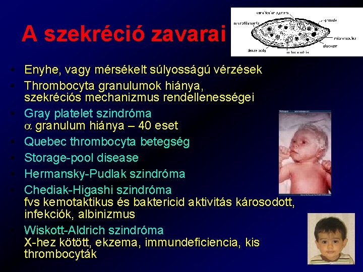 A szekréció zavarai • Enyhe, vagy mérsékelt súlyosságú vérzések • Thrombocyta granulumok hiánya, szekréciós